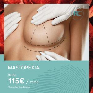 mastopexia-2-1