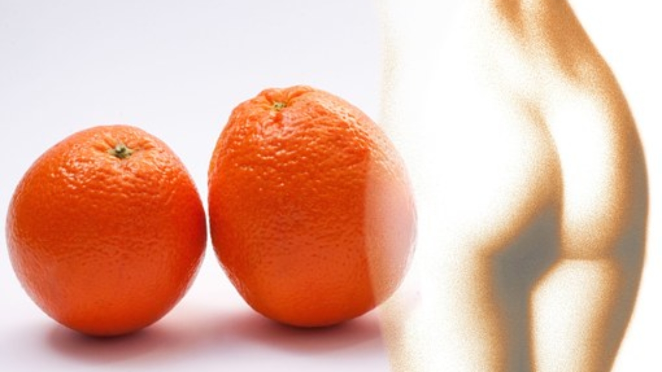 piel de naranja px